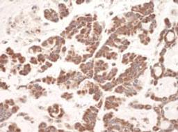 Detection of human C1QBP by immunohistochemistry.