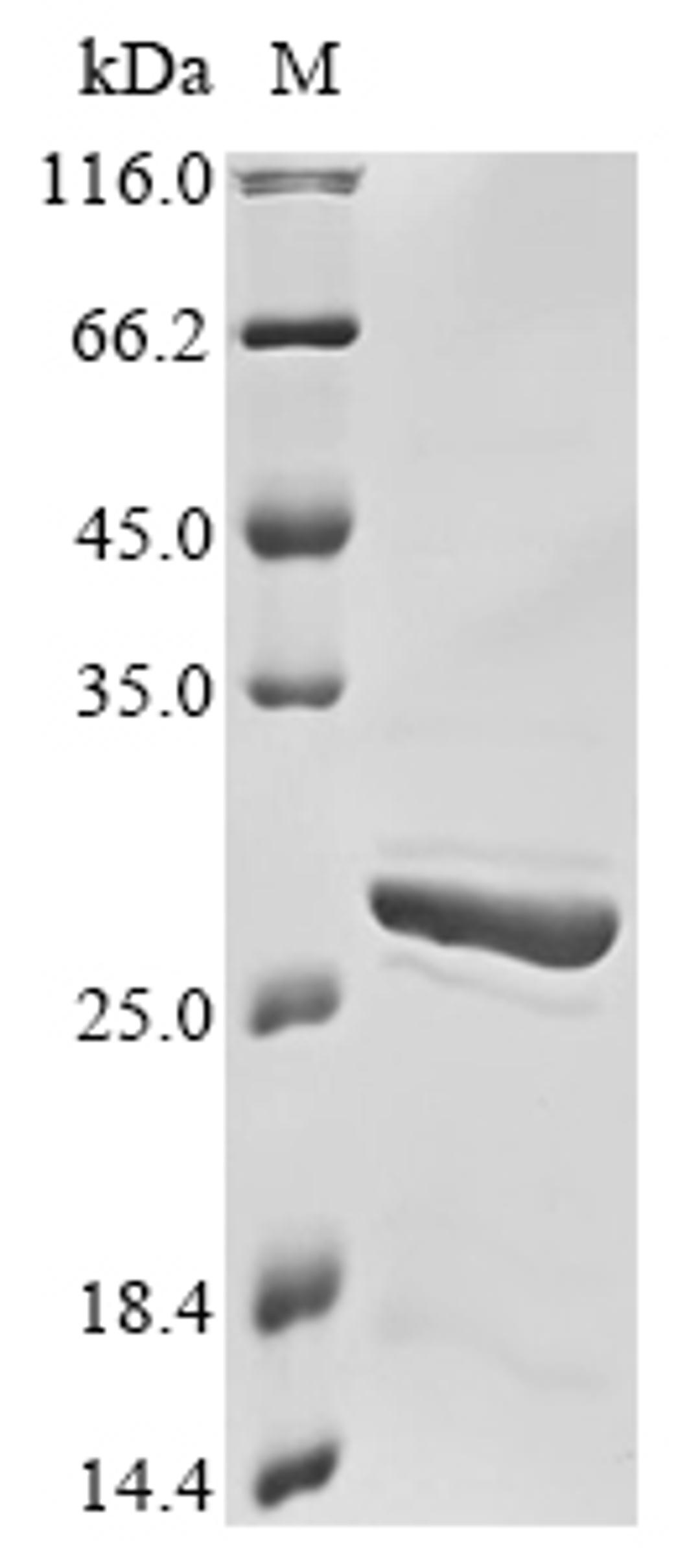 (Tris-Glycine gel) Discontinuous SDS-PAGE (reduced) with 5% enrichment gel and 15% separation gel.