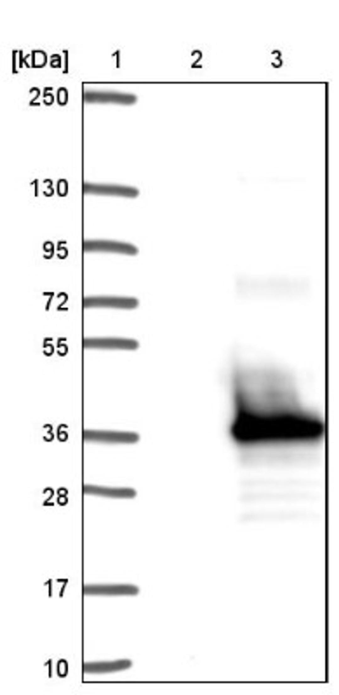 Western Blot: FAM9B Antibody [NBP1-89431] - Lane 1: Marker [kDa] 250, 130, 95, 72, 55, 36, 28, 17, 10<br/>Lane 2: Negative control (vector only transfected HEK293T lysate)<br/>Lane 3: Over-expression lysate (Co-expressed with a C-terminal myc-DDK tag (~3.1 kDa) in mammalian HEK293T cells, LY404199)