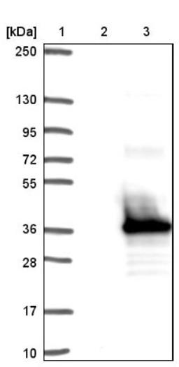 Western Blot: FAM9B Antibody [NBP1-89431] - Lane 1: Marker [kDa] 250, 130, 95, 72, 55, 36, 28, 17, 10<br/>Lane 2: Negative control (vector only transfected HEK293T lysate)<br/>Lane 3: Over-expression lysate (Co-expressed with a C-terminal myc-DDK tag (~3.1 kDa) in mammalian HEK293T cells, LY404199)