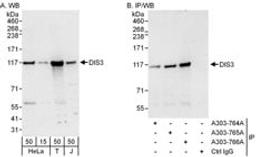 Detection of human DIS3 by western blot and immunoprecipitation.