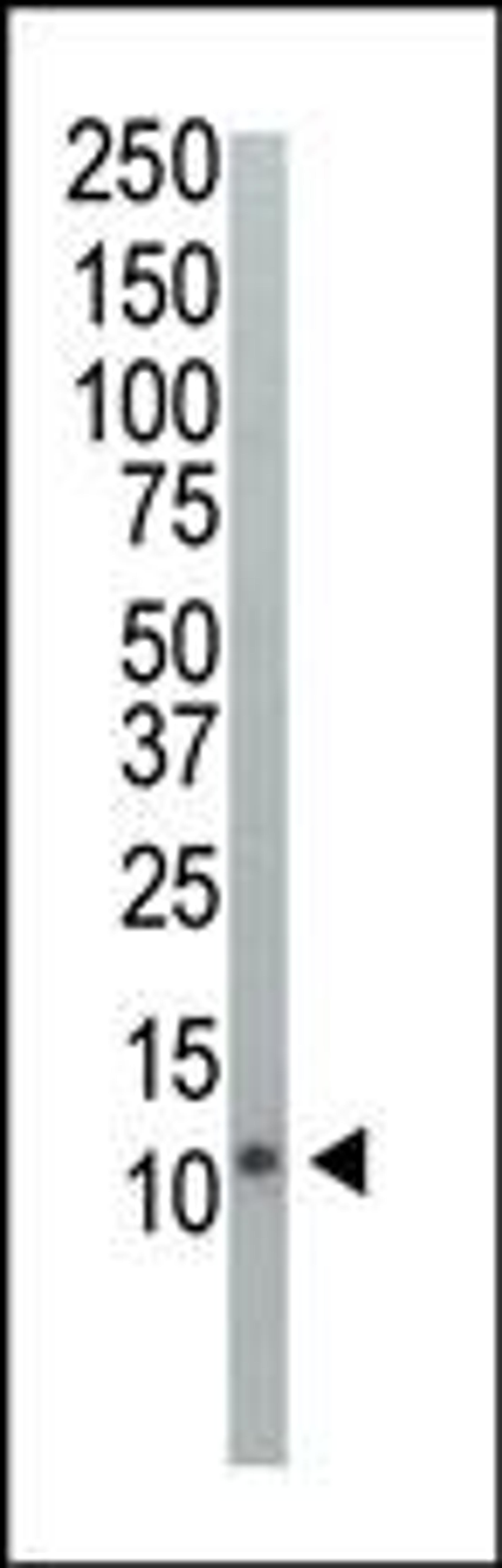 Western blot analysis of anti-Ubiquitin Pab in HeLa cell lysate. Ubiquitin was detected using purified Pab.