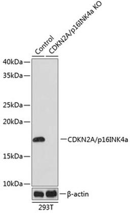 Western blot - CDKN2A/p16INK4a Rabbit mAb (A11651)