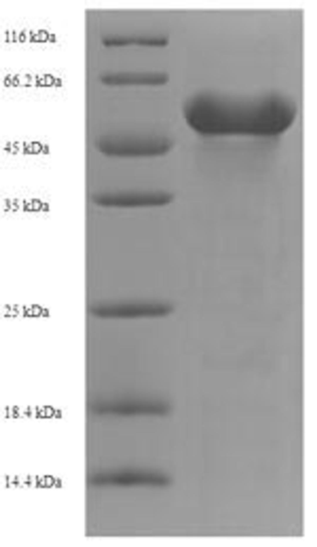 (Tris-Glycine gel) Discontinuous SDS-PAGE (reduced) with 5% enrichment gel and 15% separation gel.
