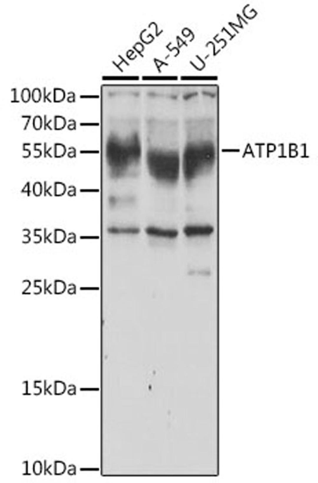 Western blot - ATP1B1 antibody (A5793)