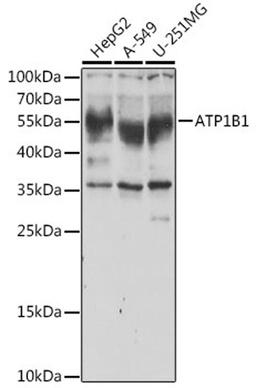 Western blot - ATP1B1 antibody (A5793)