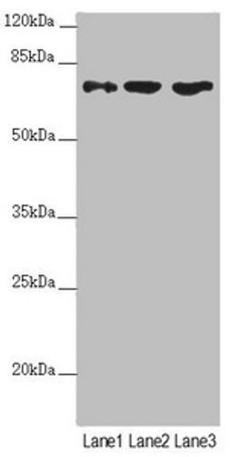 Western blot. All lanes: SCFD1 antibody at 4.48µg/ml. Lane 1: Mouse liver tissue. Lane 2: Hela whole cell lysate. Lane 3: A549 whole cell lysate. Secondary. Goat polyclonal to rabbit IgG at 1/10000 dilution. Predicted band size: 73, 63, 66 kDa. Observed band size: 73 kDa