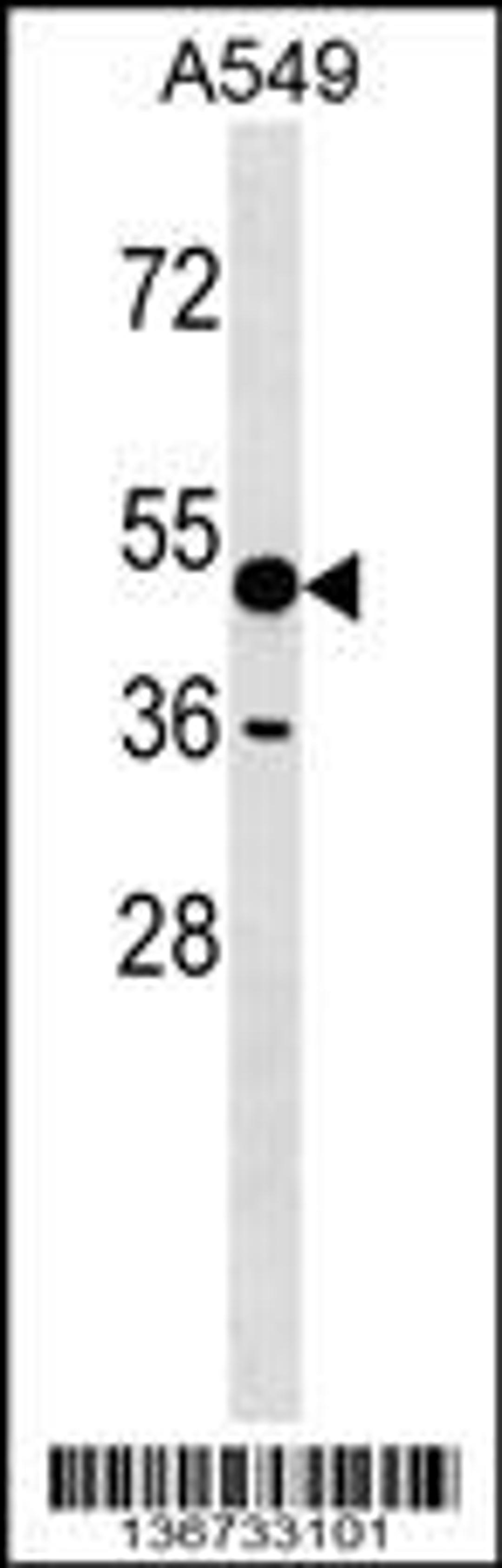 Western blot analysis in A549 cell line lysates (35ug/lane).