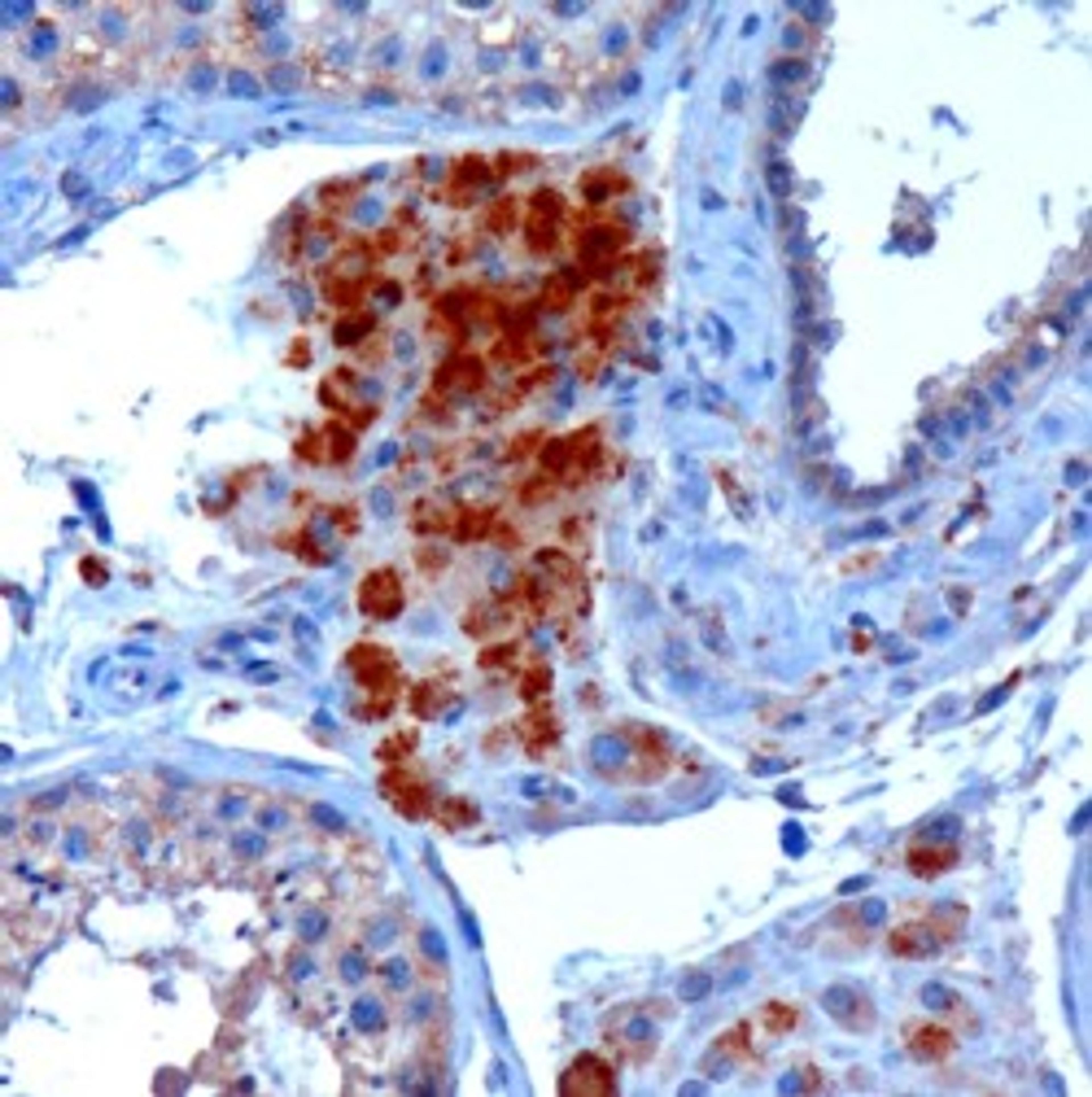 46-339 (3ug/ml) staining of paraffin embedded Human Testis. Microwaved antigen retrieval with Tris/EDTA buffer pH9, HRP-staining.