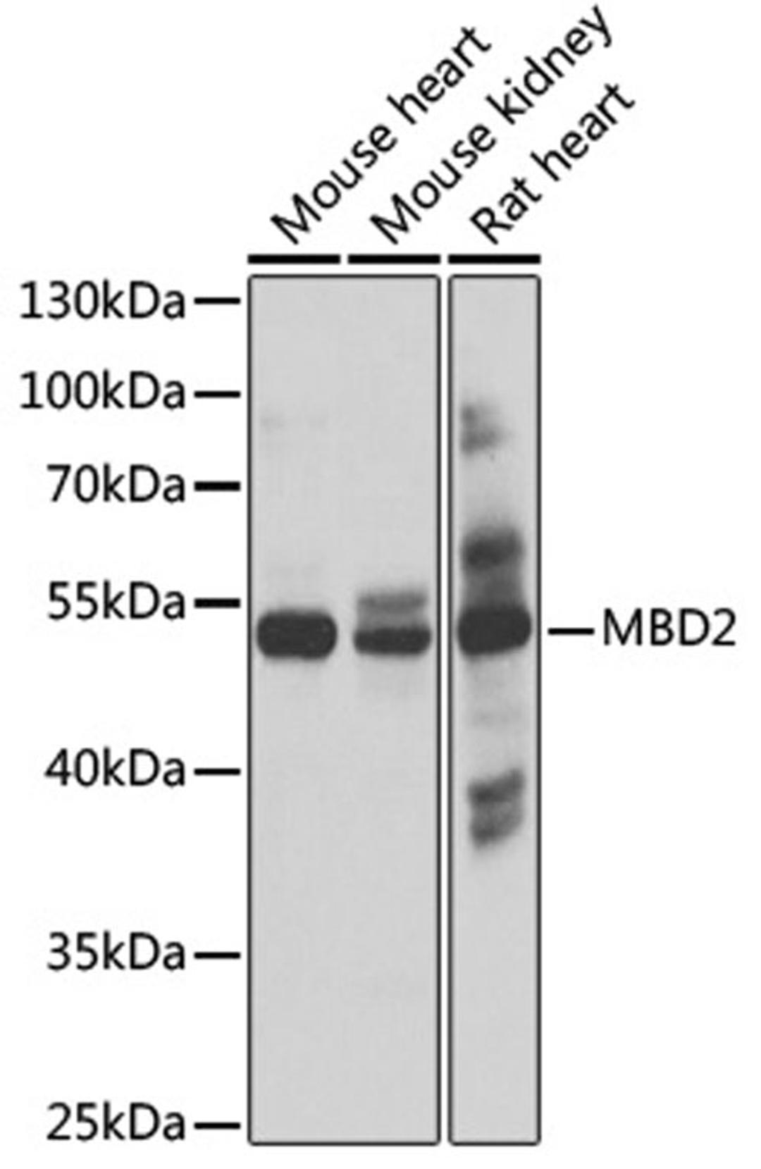 Western blot - MBD2 antibody (A2241)