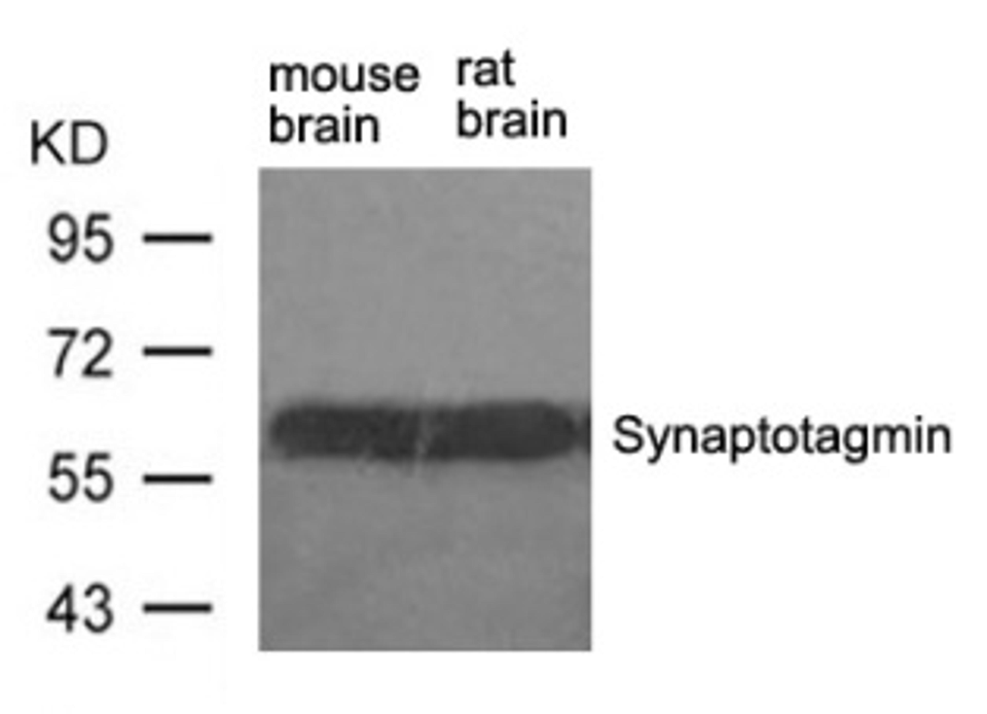 Western blot analysis of lysed extracts from mouse brain and rat brain tissue using Synaptotagmin (Ab-309).