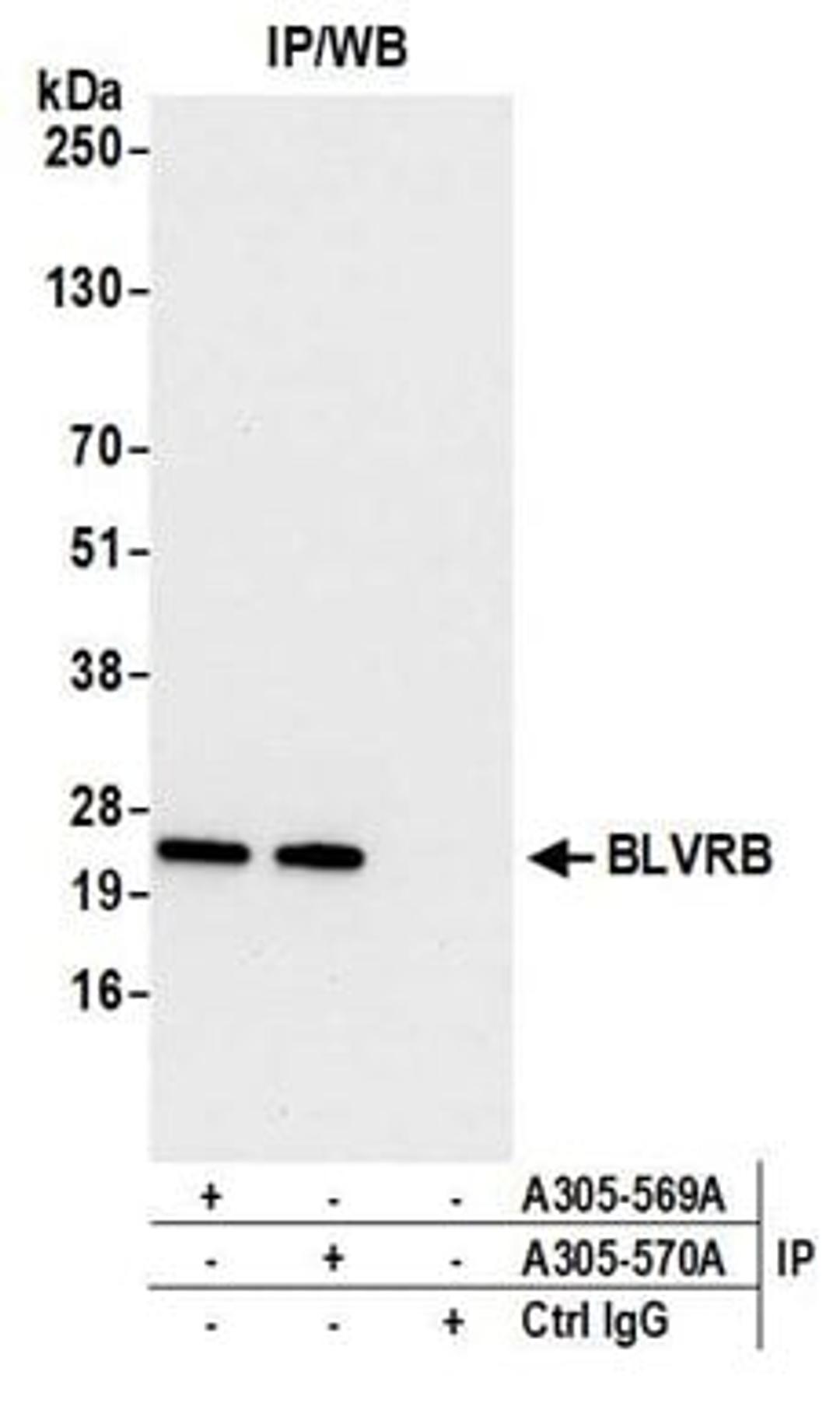 Detection of human BLVRB by western blot of immunoprecipitates.