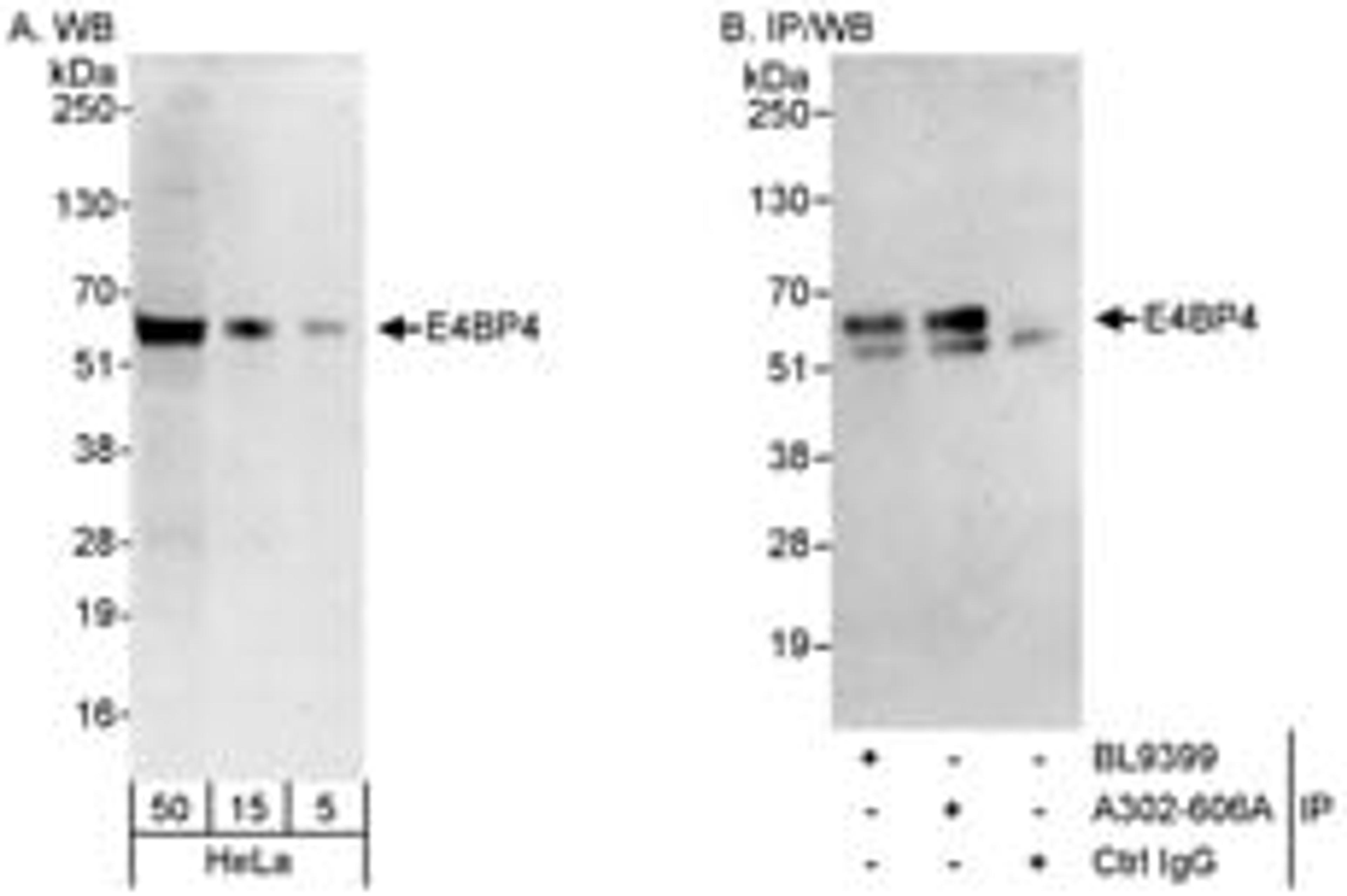 Detection of human E4BP4 by western blot and immunoprecipitation.