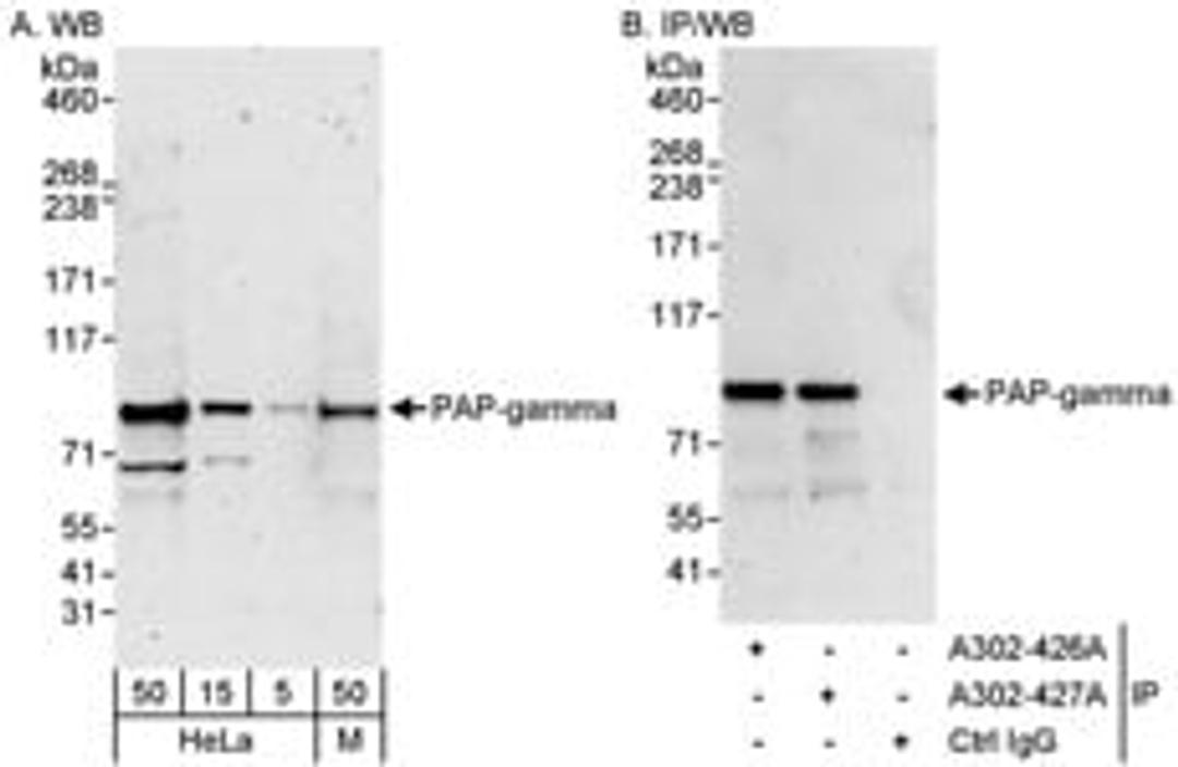 Detection of human and mouse PAP-gamma by western blot (h&m) and immunoprecipitation (h).