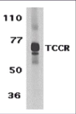 Western blot analysis of TCCR expression in human spleen tissue lysate with TCCR antibody at 1 &#956;g /ml.