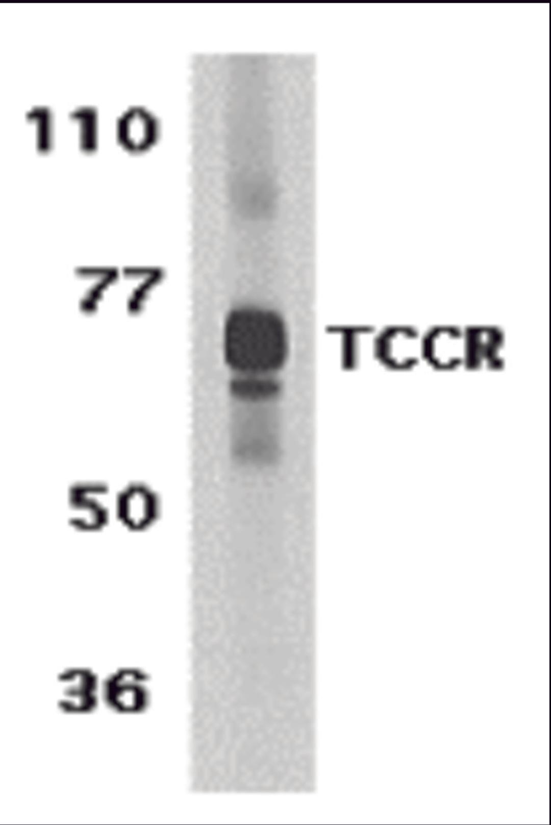 Western blot analysis of TCCR expression in human spleen tissue lysate with TCCR antibody at 1 μg /ml.