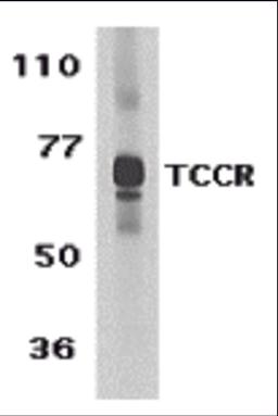 Western blot analysis of TCCR expression in human spleen tissue lysate with TCCR antibody at 1 μg /ml.