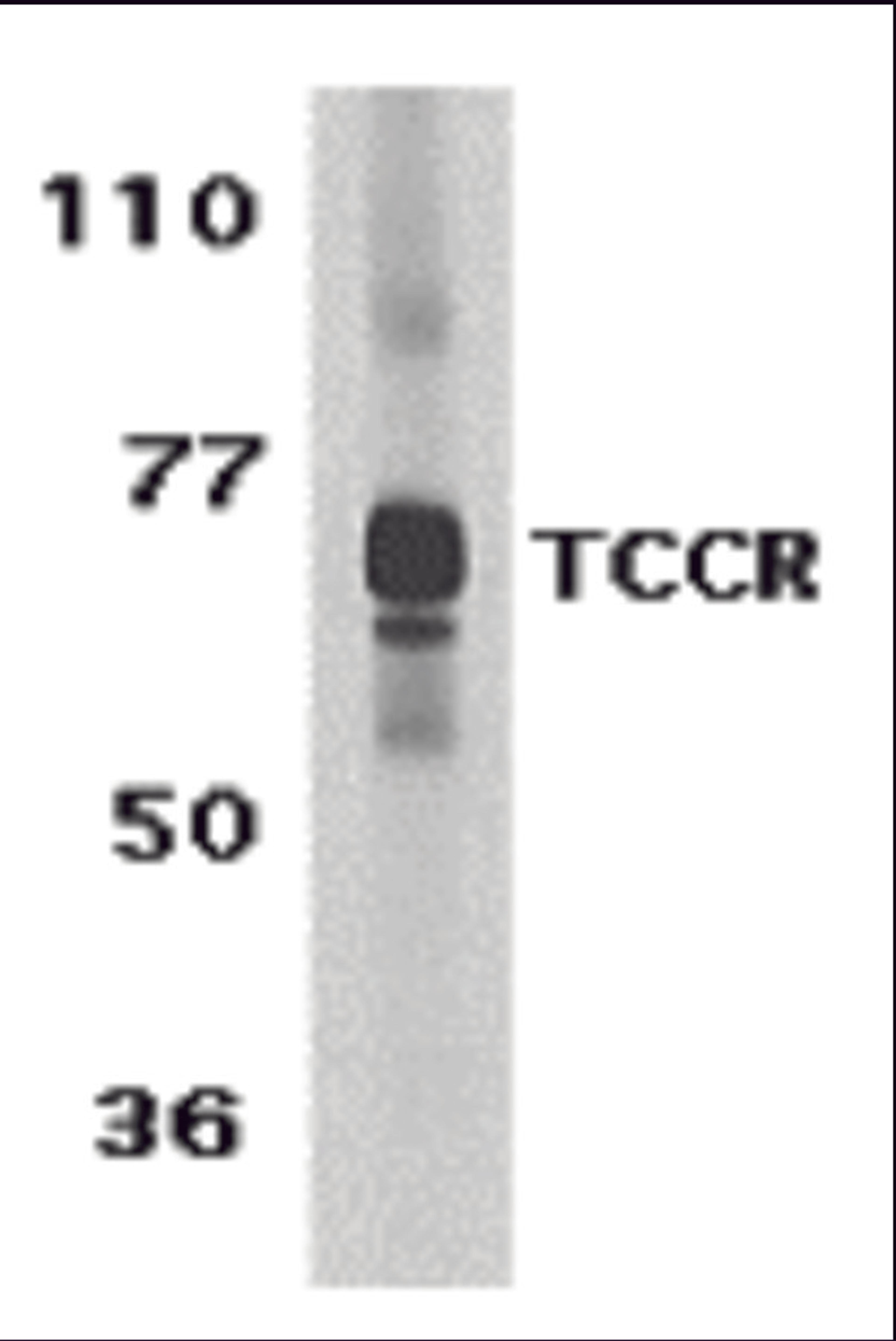 Western blot analysis of TCCR expression in human spleen tissue lysate with TCCR antibody at 1 μg /ml.