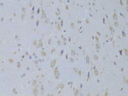 Immunohistochemistry  - IGF2 Antibody (A14005)