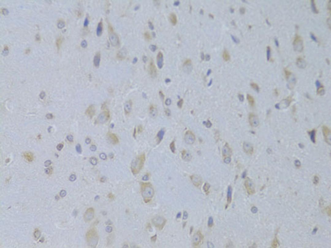 Immunohistochemistry - IGF2 Antibody (A14005)