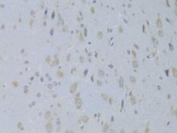Immunohistochemistry - IGF2 Antibody (A14005)