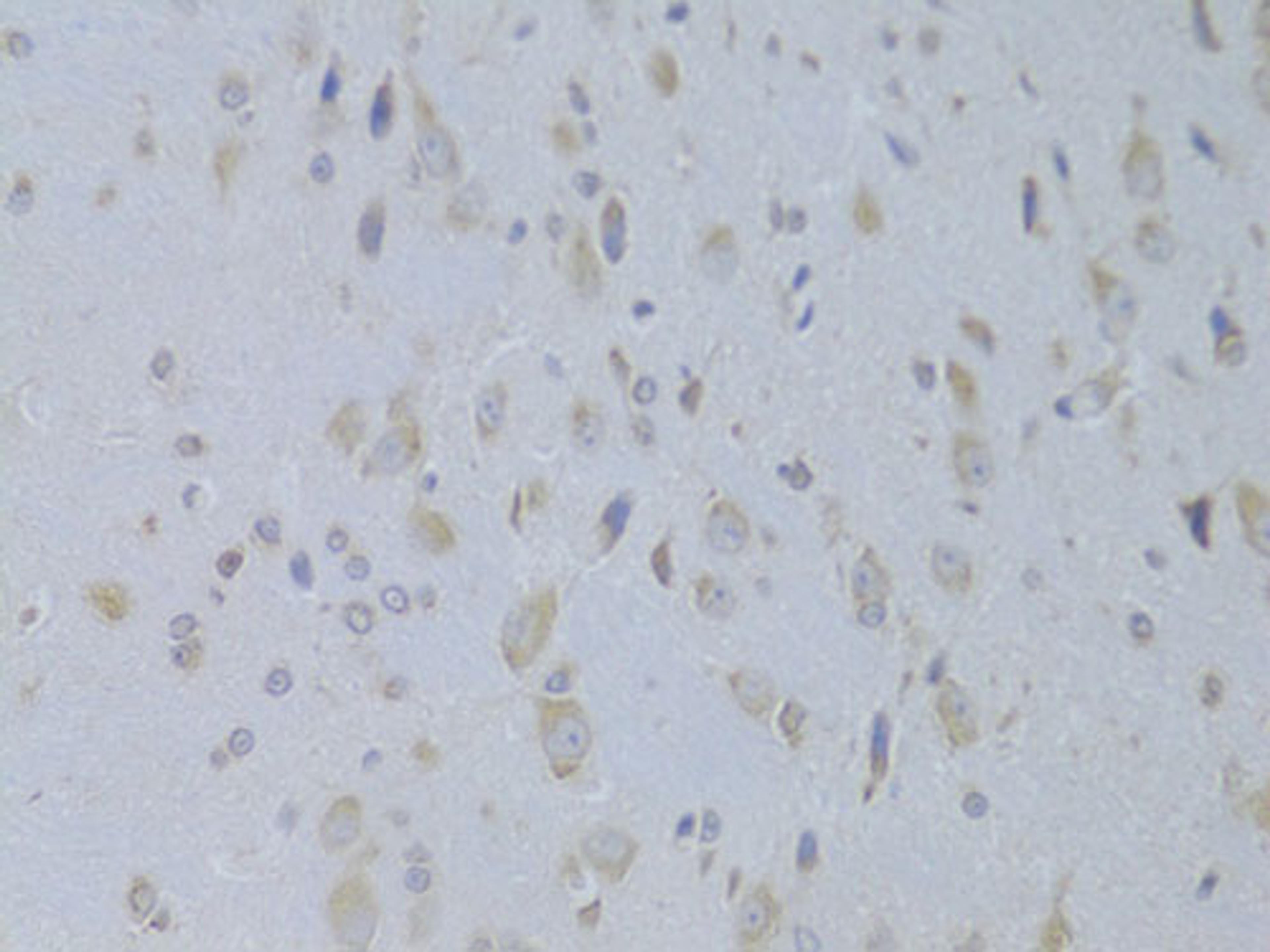 Immunohistochemistry - IGF2 Antibody (A14005)