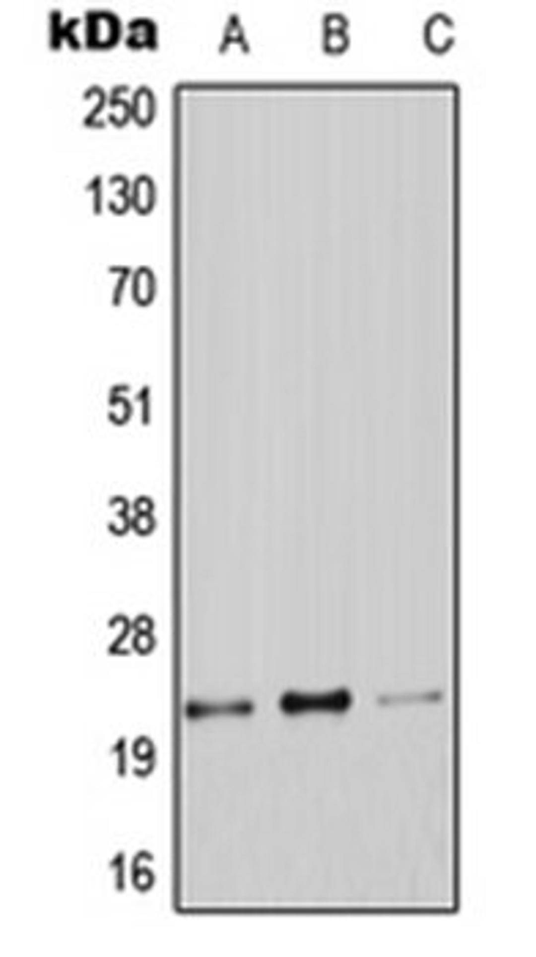 Western blot analysis of A549 (Lane 1), Raw264.7 (Lane 2), PC12 (Lane 3) whole cell lysates using CLDN9 antibody