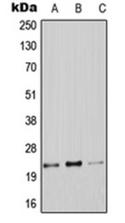 Western blot analysis of A549 (Lane 1), Raw264.7 (Lane 2), PC12 (Lane 3) whole cell lysates using CLDN9 antibody