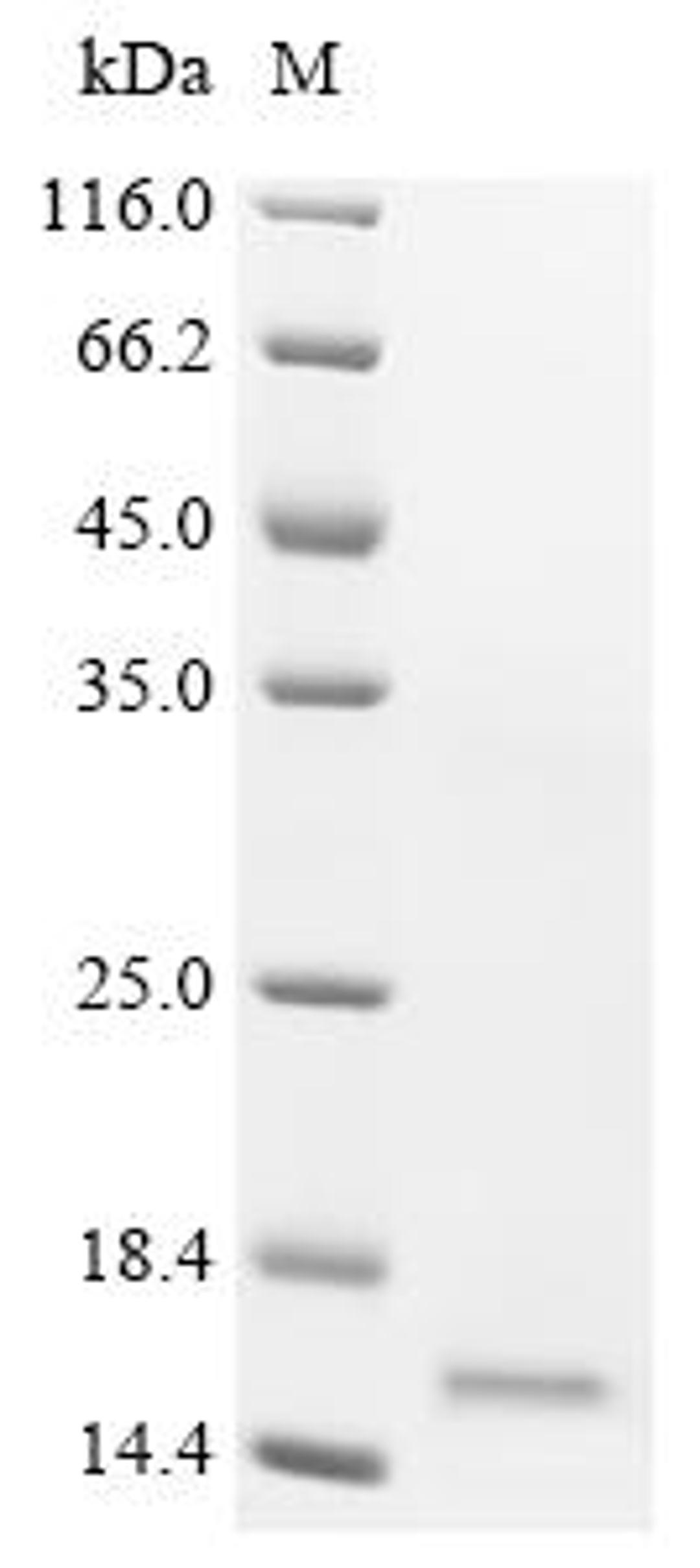 (Tris-Glycine gel) Discontinuous SDS-PAGE (reduced) with 5% enrichment gel and 15% separation gel.