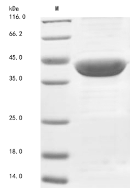 (Tris-Glycine gel) Discontinuous SDS-PAGE (reduced) with 5% enrichment gel and 15% separation gel.
