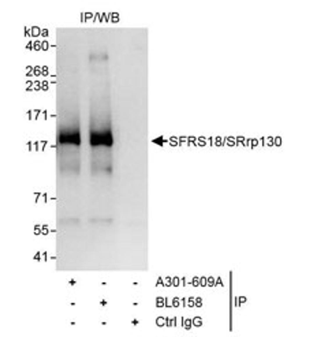 Detection of human SFRS18/SRrp130 by western blot of immunoprecipitates.