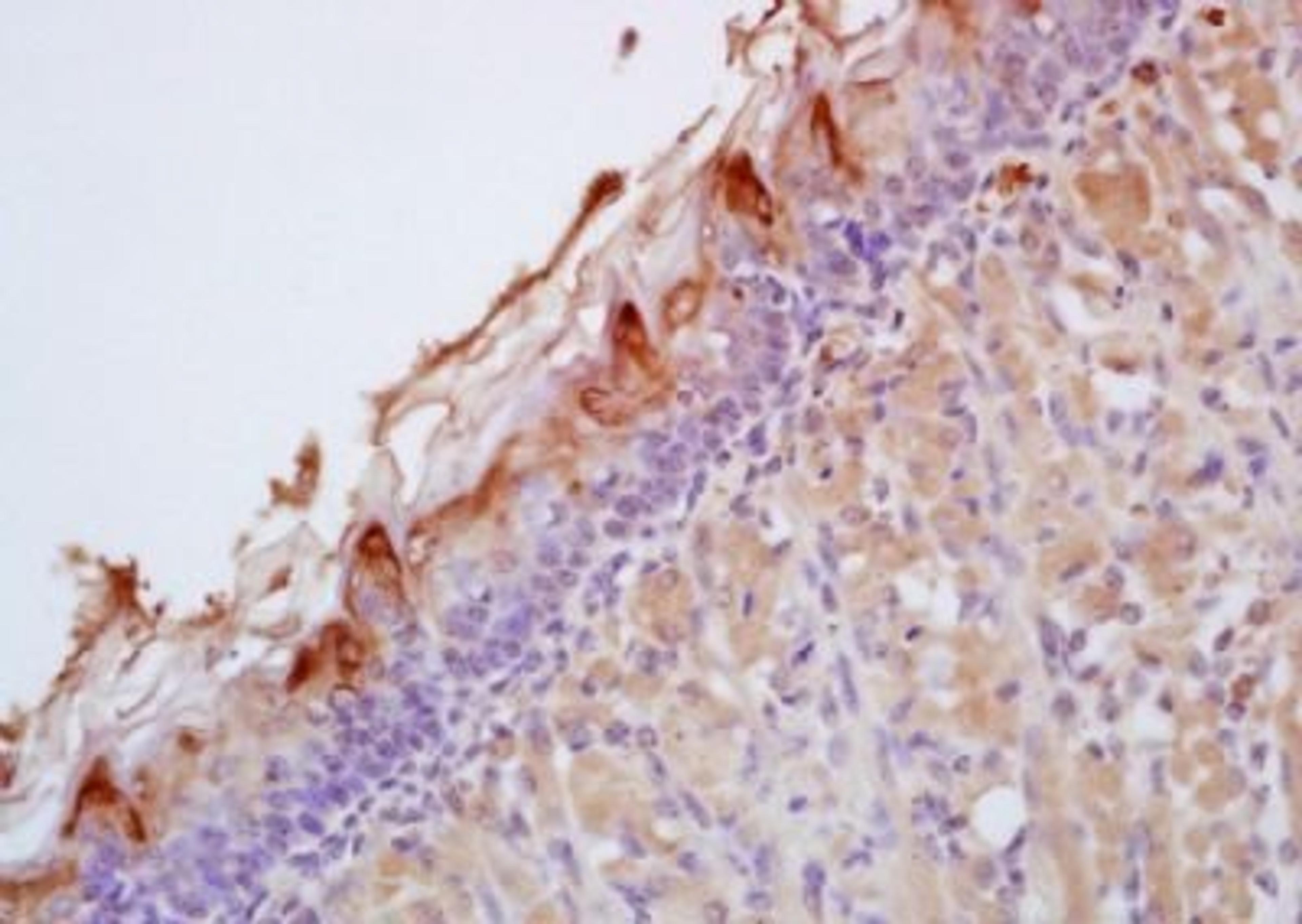 Immunohistochemical analysis of formalin-fixed paraffin embedded mouse skin tissue using SPRR1a antibody (dilution at 1:200)