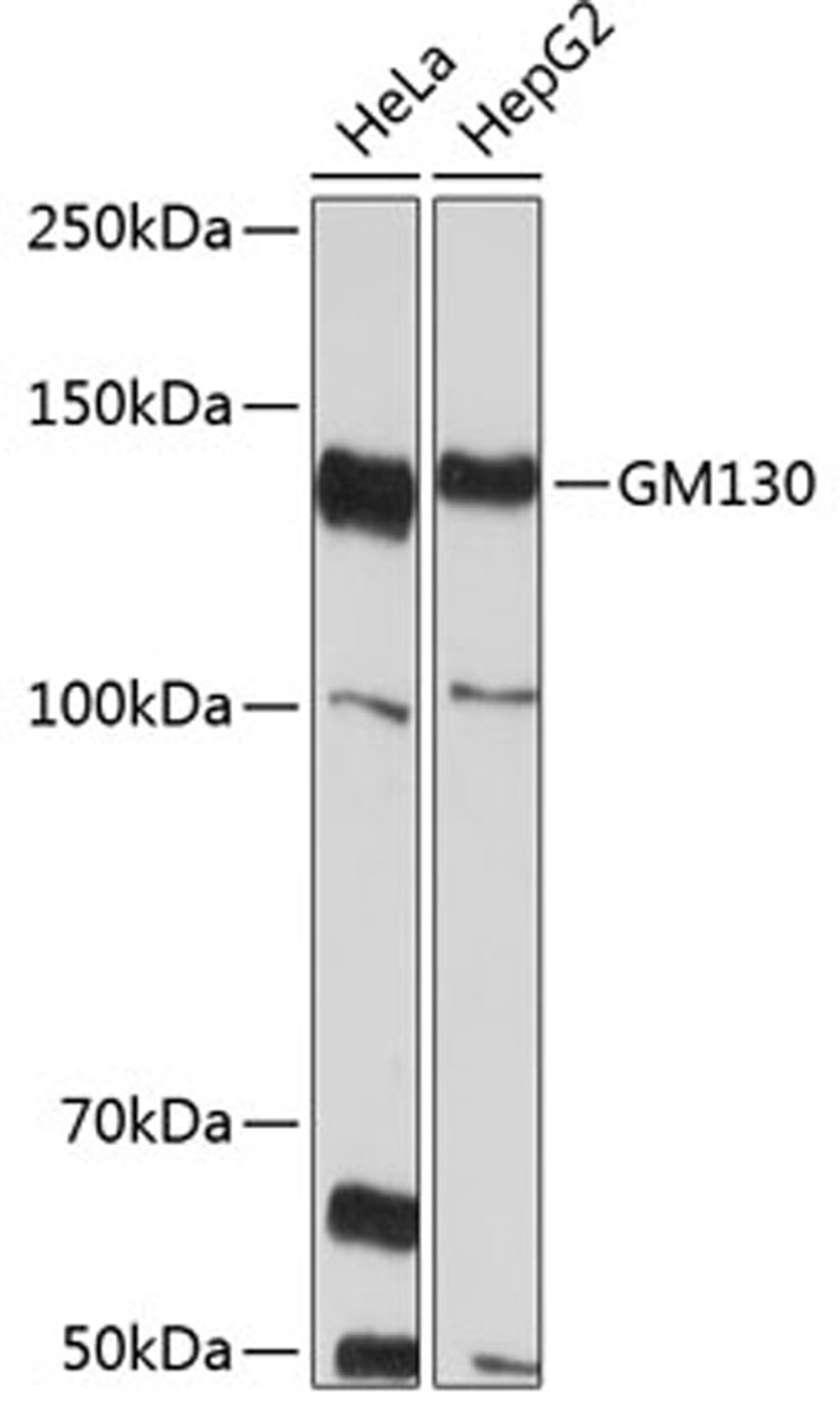 Western blot - GM130 Rabbit mAb (A11408)