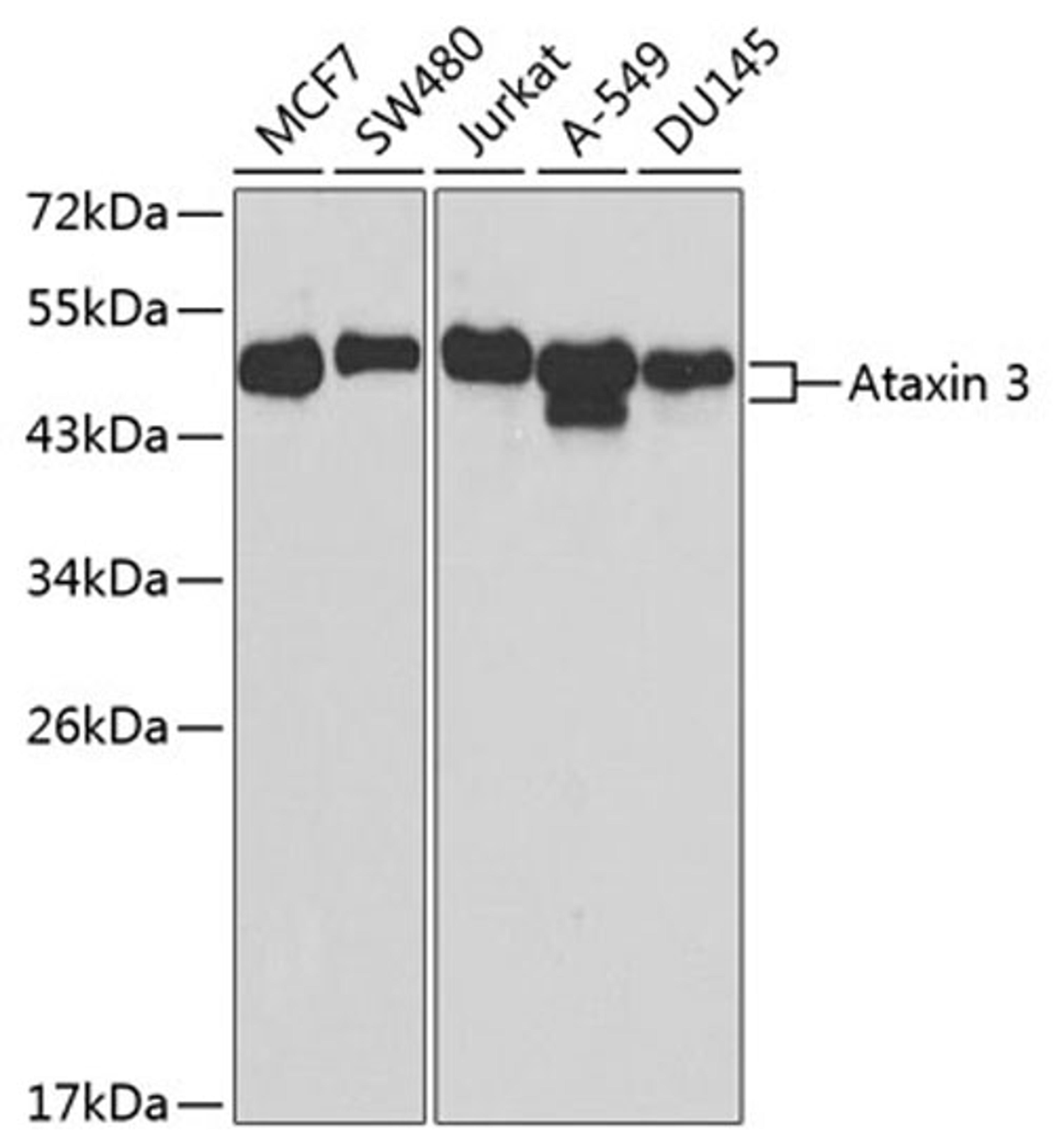 Western blot - Ataxin 3 antibody (A12992)