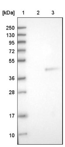 Western Blot: ATF5 Antibody [NBP1-89435] - Lane 1: Marker [kDa] 250, 130, 95, 72, 55, 36, 28, 17, 10<br/>Lane 2: Negative control (vector only transfected HEK293T lysate)<br/>Lane 3: Over-expression lysate (Co-expressed with a C-terminal myc-DDK tag (~3.1 kDa) in mammalian HEK293T cells, LY402139)