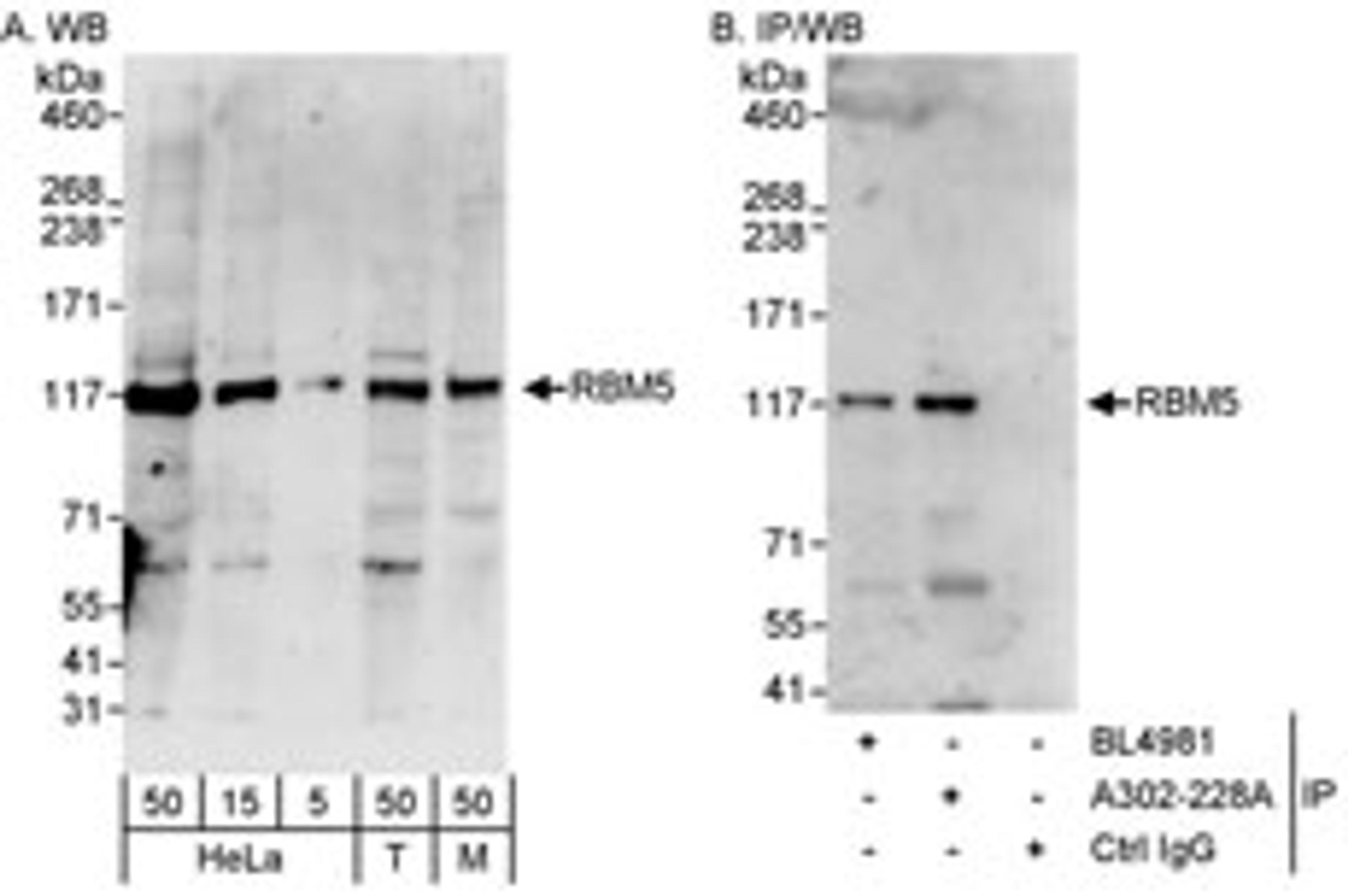 Detection of human and mouse RBM5 by western blot (h&m) and immunoprecipitation (h).