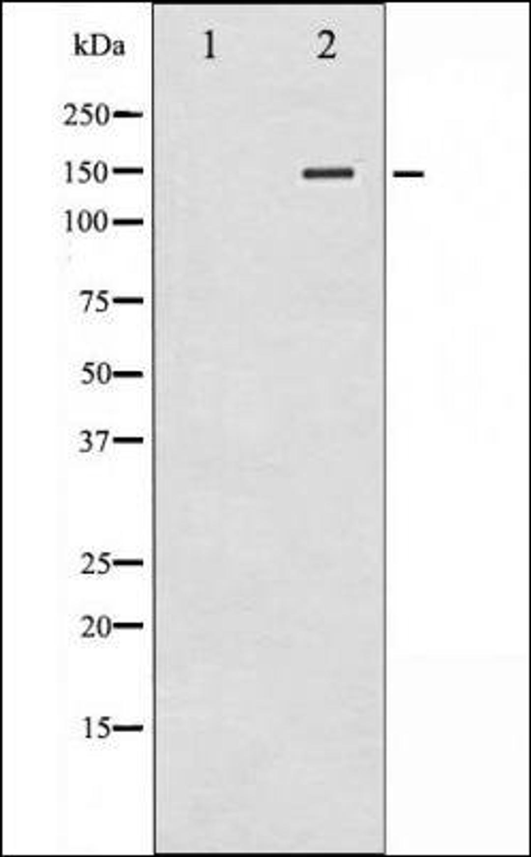 Western blot analysis of whole cell lysates using iNOS -Phospho-Tyr151- antibody