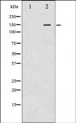 Western blot analysis of whole cell lysates using iNOS -Phospho-Tyr151- antibody