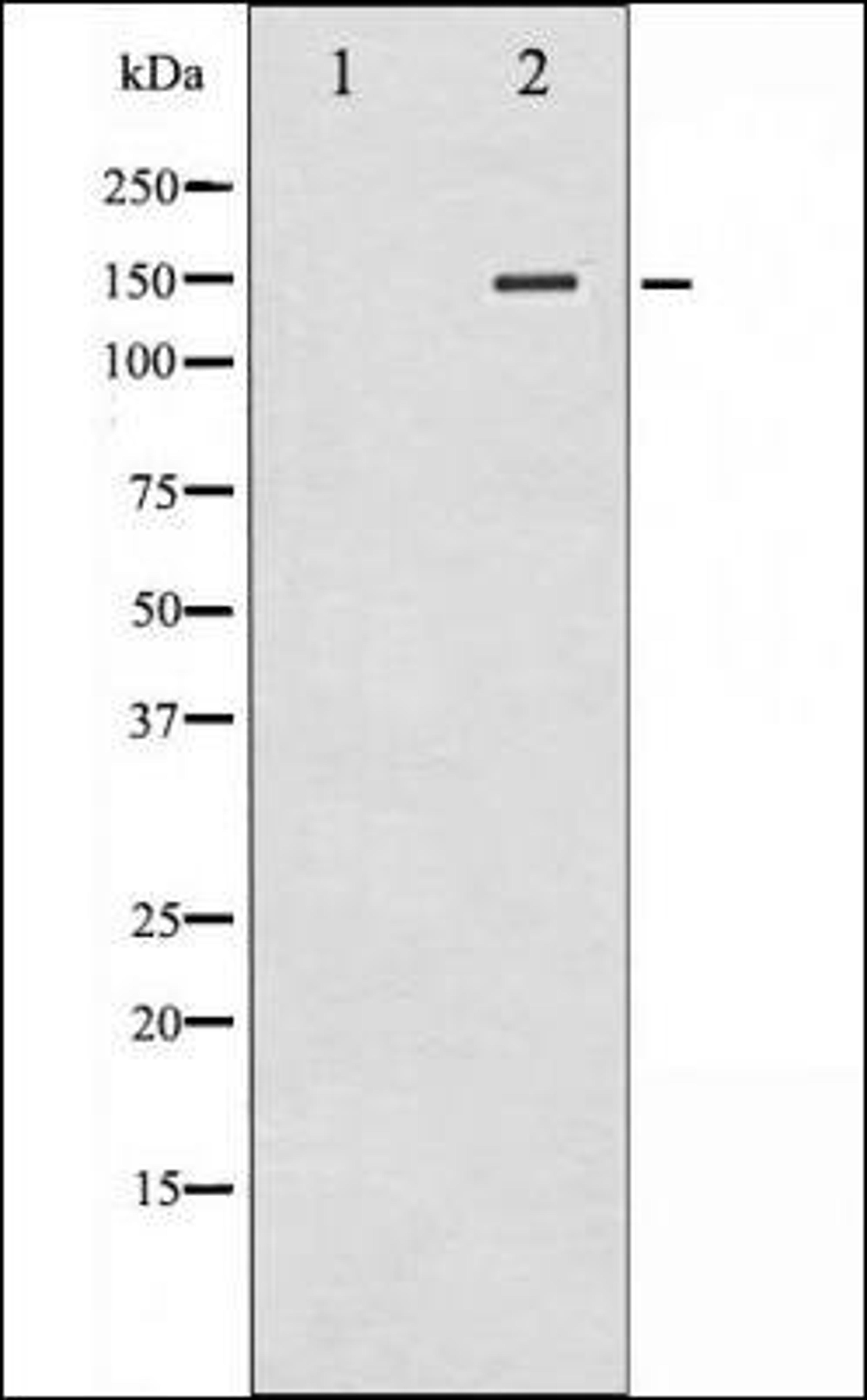 Western blot analysis of whole cell lysates using iNOS -Phospho-Tyr151- antibody