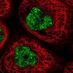 Immunocytochemistry/Immunofluorescence: DDX46 Antibody [NBP1-83565] - Staining of human cell line A-431 shows positivity in nucleus.