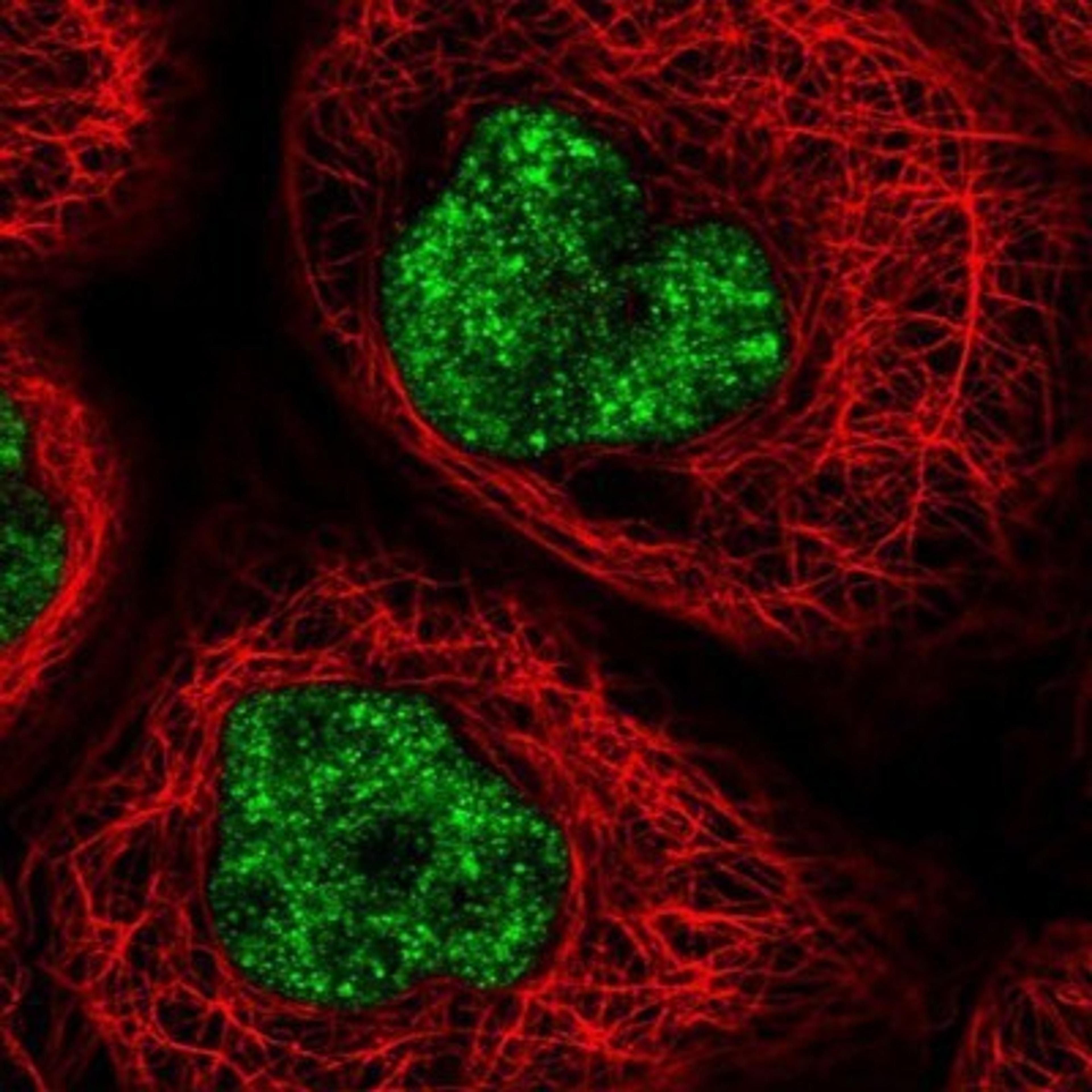 Immunocytochemistry/Immunofluorescence: DDX46 Antibody [NBP1-83565] - Staining of human cell line A-431 shows positivity in nucleus.