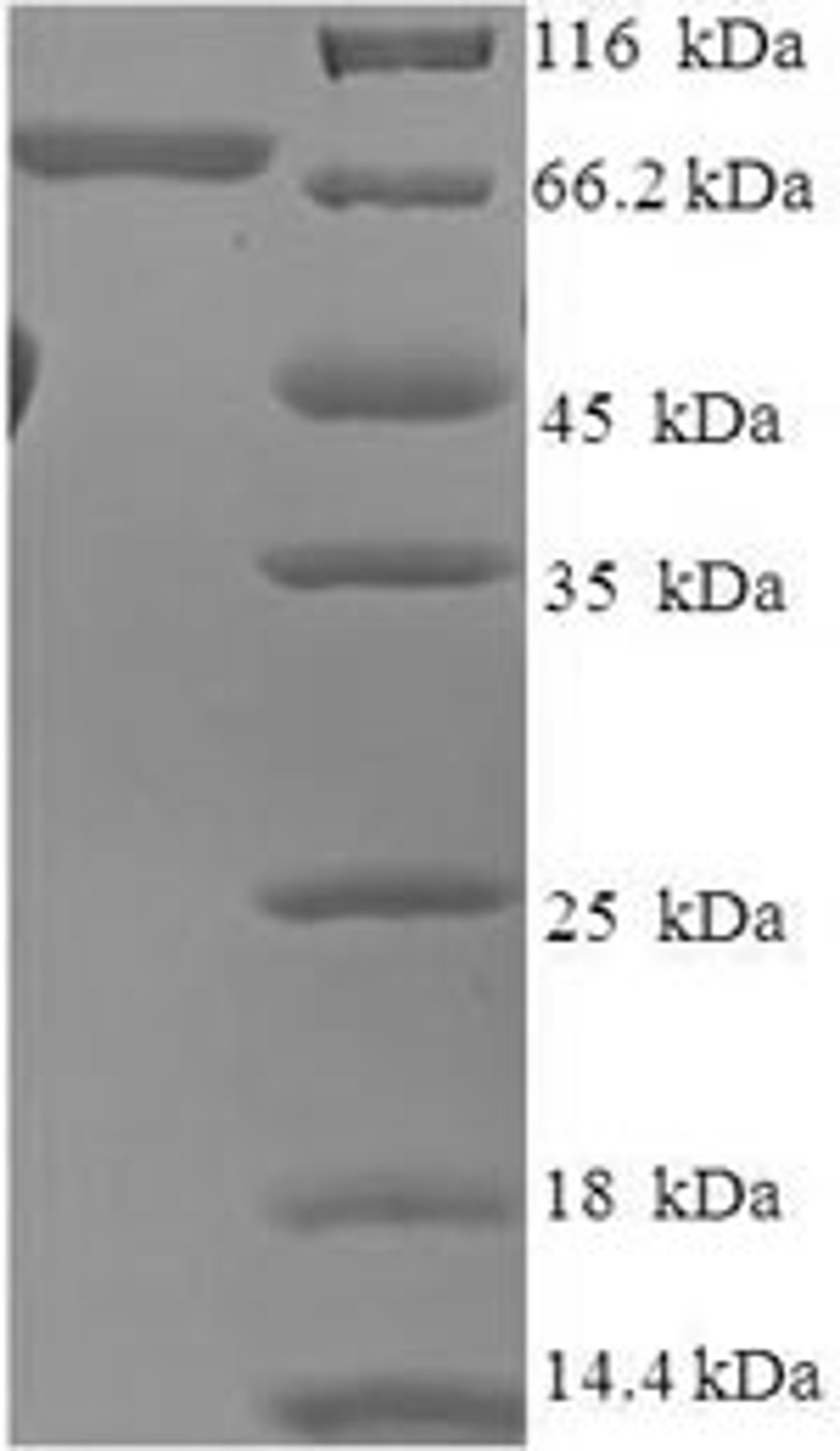 (Tris-Glycine gel) Discontinuous SDS-PAGE (reduced) with 5% enrichment gel and 15% separation gel.