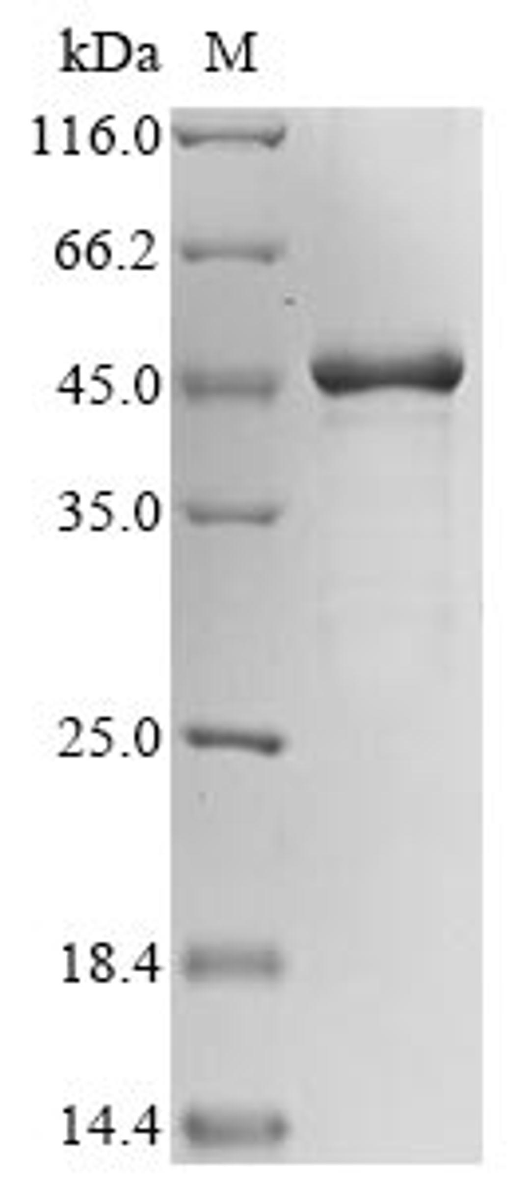 (Tris-Glycine gel) Discontinuous SDS-PAGE (reduced) with 5% enrichment gel and 15% separation gel.