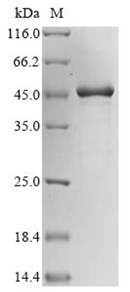 (Tris-Glycine gel) Discontinuous SDS-PAGE (reduced) with 5% enrichment gel and 15% separation gel.