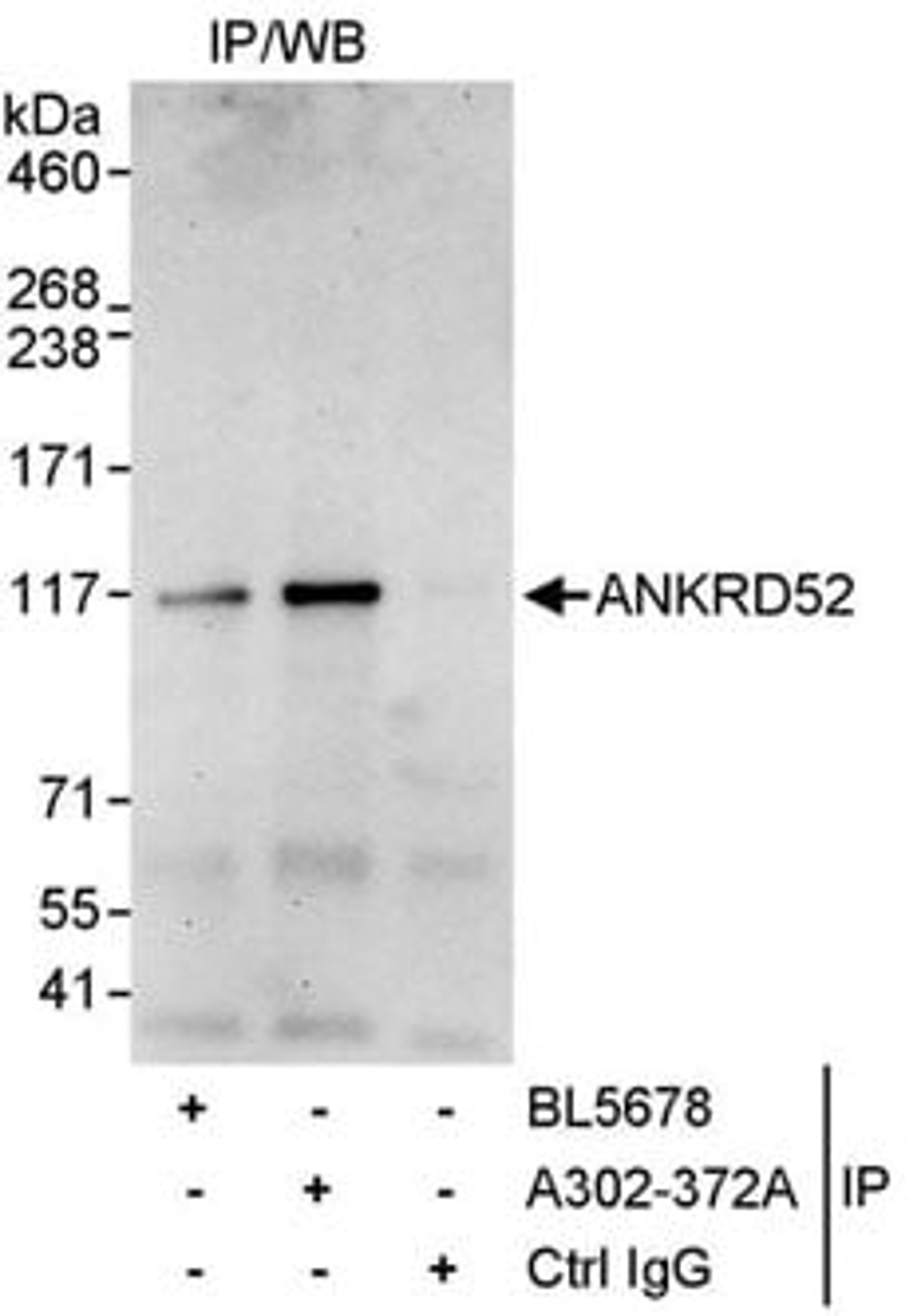 Detection of human ANKRD52 by western blot of immunoprecipitates.