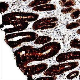 Immunohistochemical analysis of paraffin embedded human stomach tissue using LLGL1 antibody 