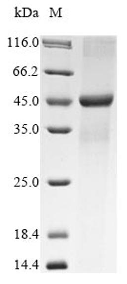 (Tris-Glycine gel) Discontinuous SDS-PAGE (reduced) with 5% enrichment gel and 15% separation gel.