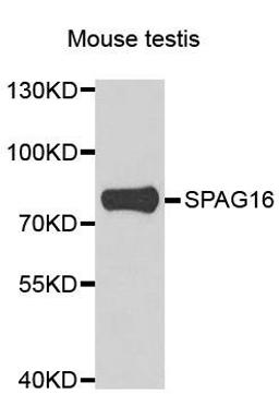 Western blot analysis of extracts of mouse testis using SPAG16 antibody