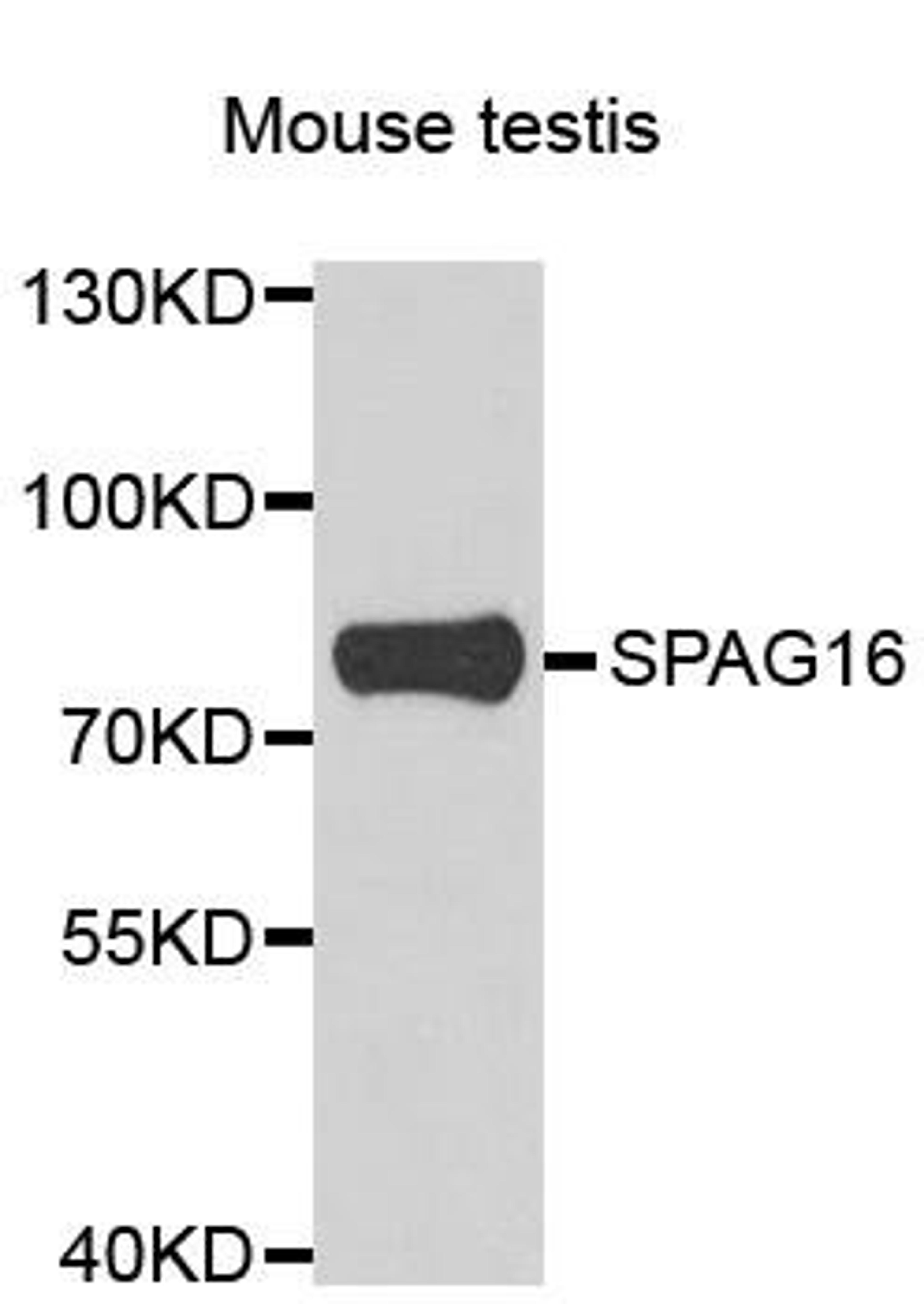 Western blot analysis of extracts of mouse testis using SPAG16 antibody