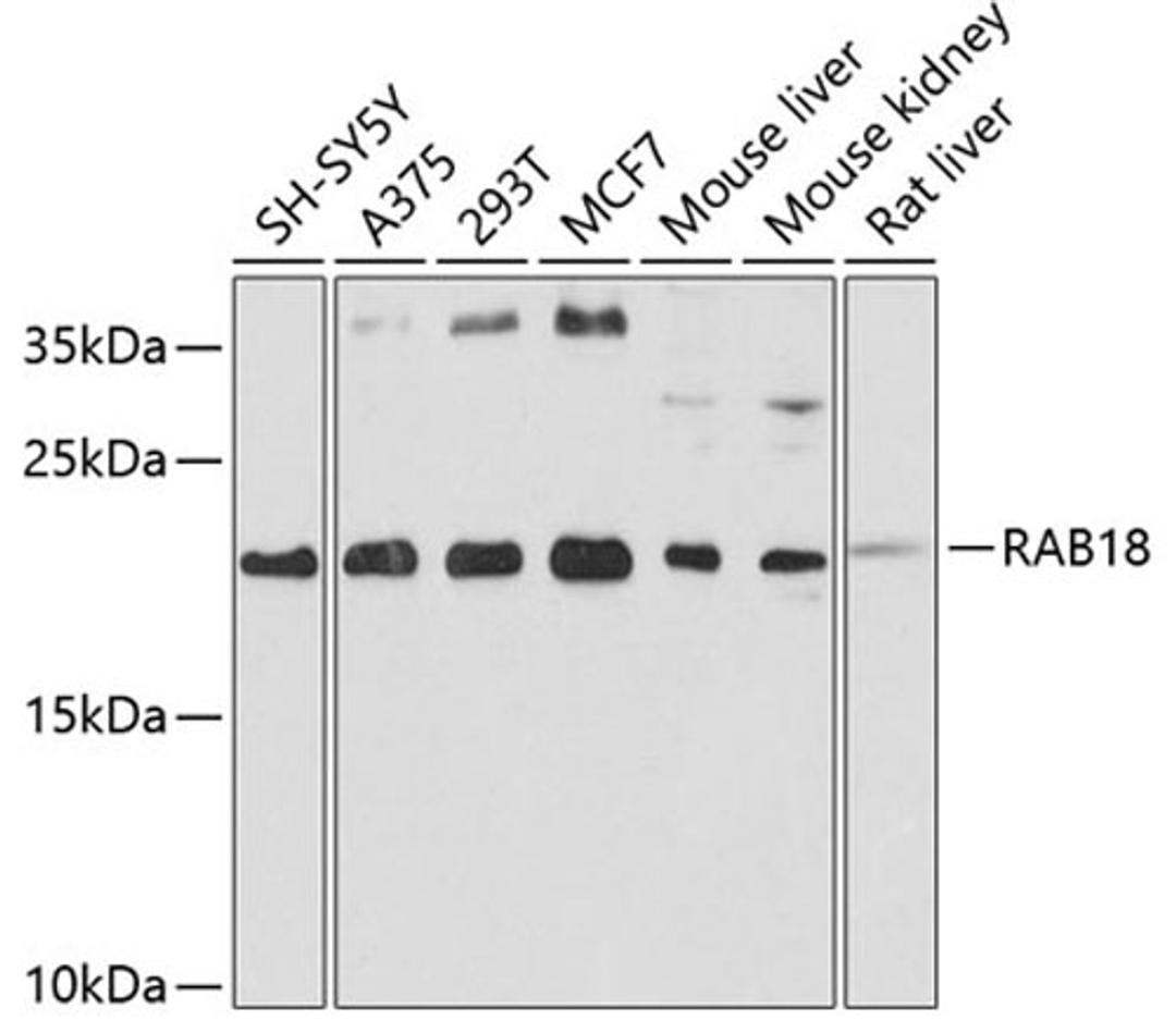 Western blot - RAB18 antibody (A2812)